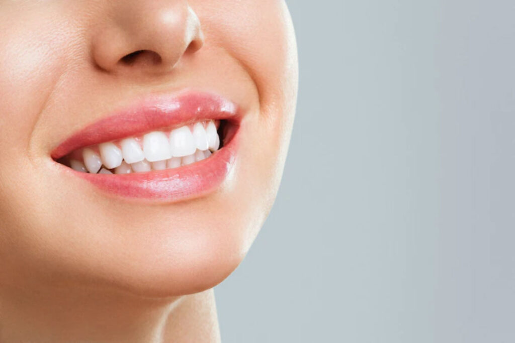 How to Whiten Teeth Naturally with Safe Home Remedies