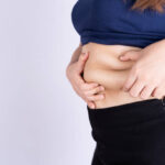 Who Needs Tummy Tuck Surgery? Ideal Candidates Explored