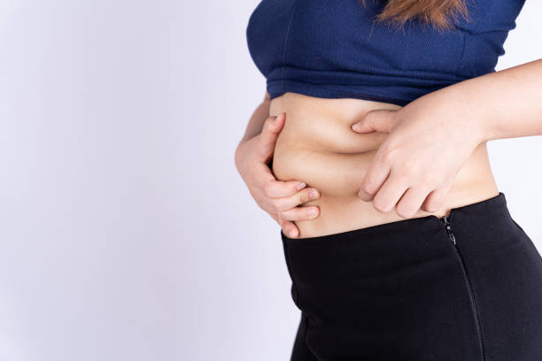 Who Needs Tummy Tuck Surgery? Ideal Candidates Explored