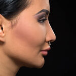 Emotional Side of Rhinoplasty: Coping with Procedure Anxiety