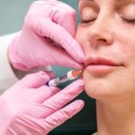 How a European facial supports natural skin balance