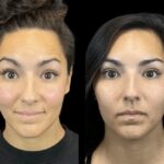 Best Plastic Surgeon in Dubai Explains How Botox Enhances Surgical Results