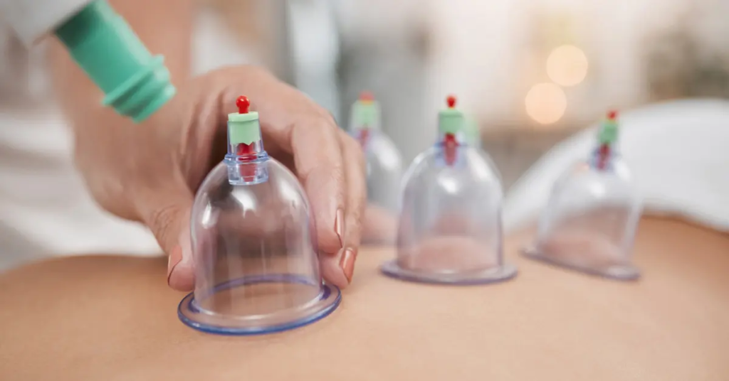 Hijama Treatment Cost and Its Role in Treatment Planning