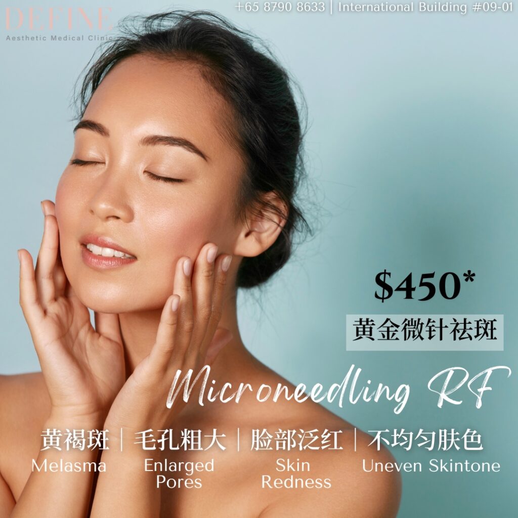 sylfirm microneedling singapore