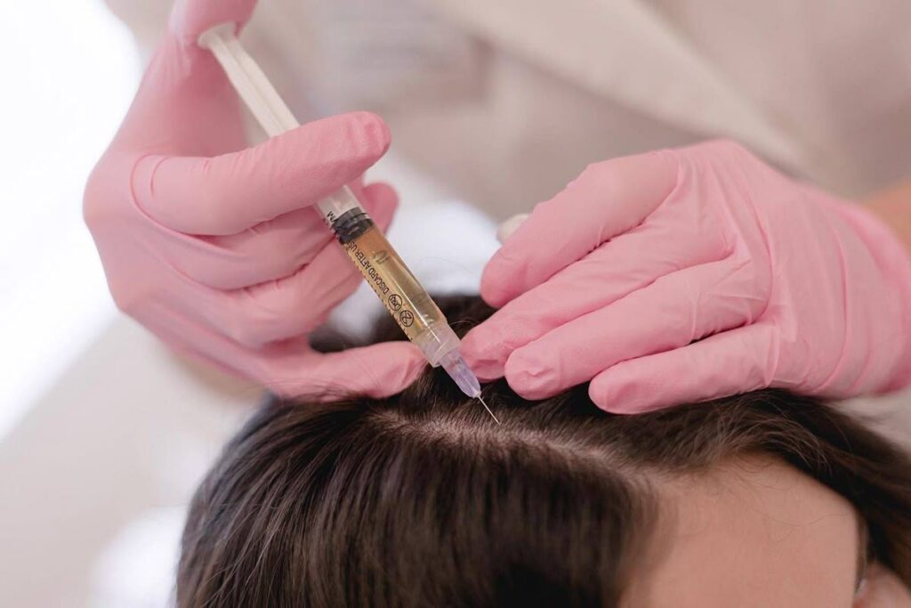 The Science Behind PRP Hair Treatment in Dubai for Hair Restoration