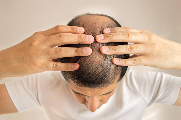 Effective Hair Loss Treatment in Dubai: A Clinical Guide