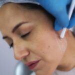 Jawline Fillers in Dubai: A Clinical Guide to Facial Contouring