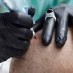 Scalp Micropigmentation in Dubai: A Complete Guide to Results