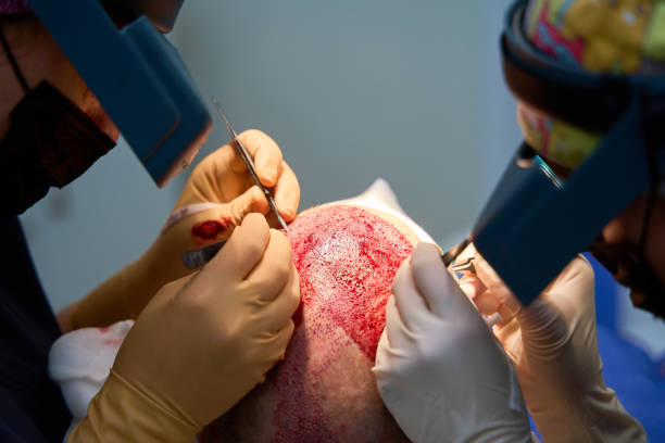 Hair Transplant in Sharjah: Pre-Procedure Checklist
