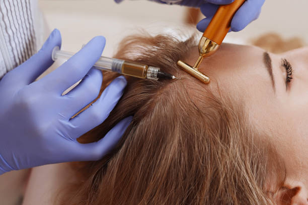 PRP Hair Treatment in Abu Dhabi Strengthens Weak Hair Roots