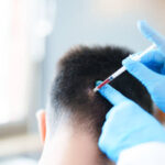 GFC Hair Treatment in Dubai Strengthens Weak Roots