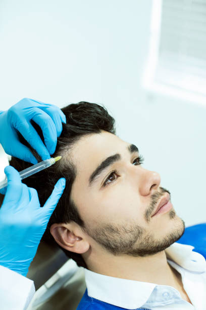 Hair Fillers Treatment in Dubai for Men with Receding Temples