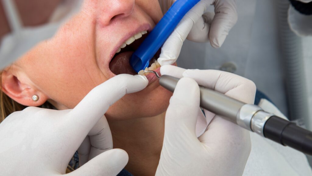 Trusted Dentist in Diamond Bar for Family Dental Care