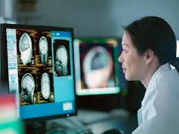 Expert Neurologists in Guwahati for Advanced Brain and Nerve Care