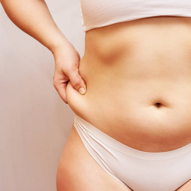 Mini Abdominoplasty in Dubai: Cost Breakdown and Savings