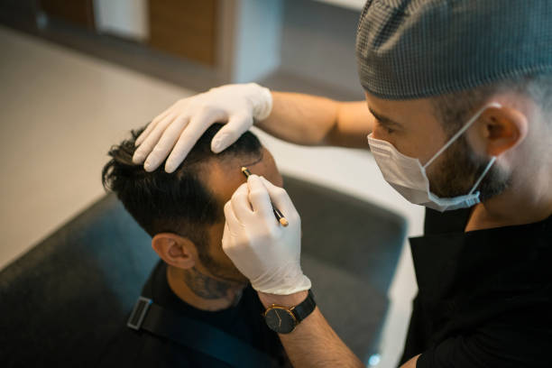 Frontline Hair Fixing in Dubai: Non-Surgical Hairline Reconstruction