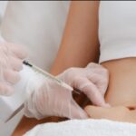 Lipolysis Injection In Dubai Target Stubborn Fat Without Surgery