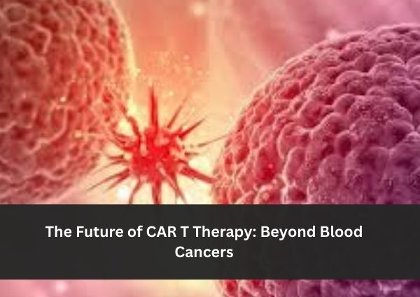 The Future of CAR T Therapy: Beyond Blood Cancers