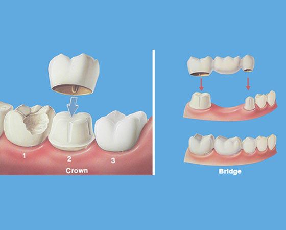 Capital Dental Clinic in Madinaguda | Best Dental Hospital in Madinaguda – Dr. Yamini Mannava