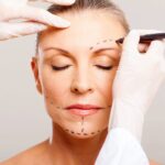 Maximize Your Results With Expert Insights Into Facelift Surgery Cost