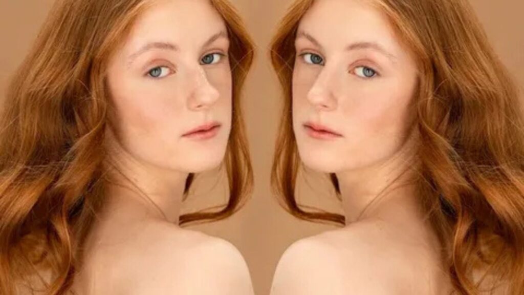 Expert Rhinoplasty Surgery in Delhi for Natural Facial Harmony