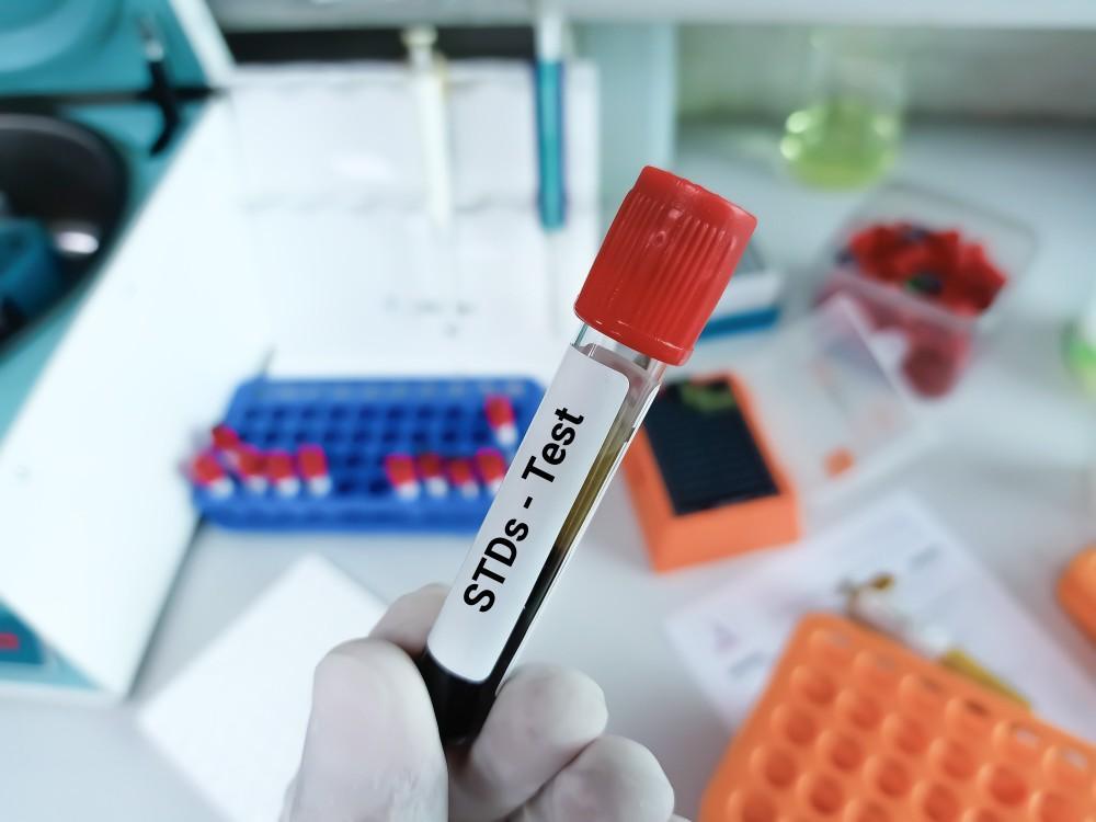 STD Test in Dubai: Comprehensive STI Panels for Men