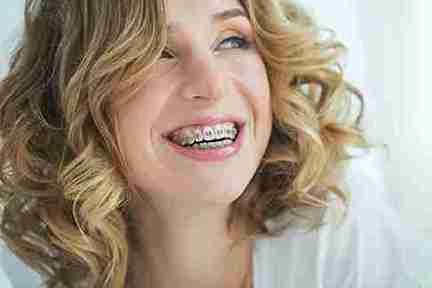 Protect Your Braces During Winter Sports: Orthodontist Advice