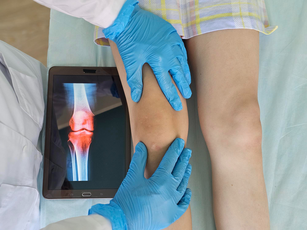 Best Exercises After Knee Replacement Surgery: Faster Recovery Tips