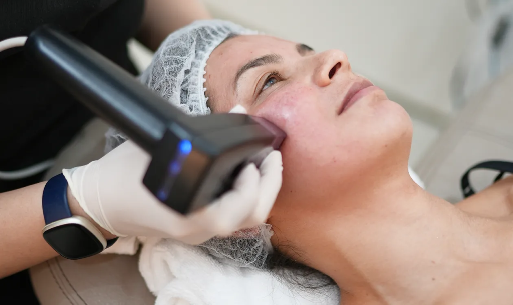 Can Morpheus8 Treatment Revitalize Luminous Complexion Smoothly Safely