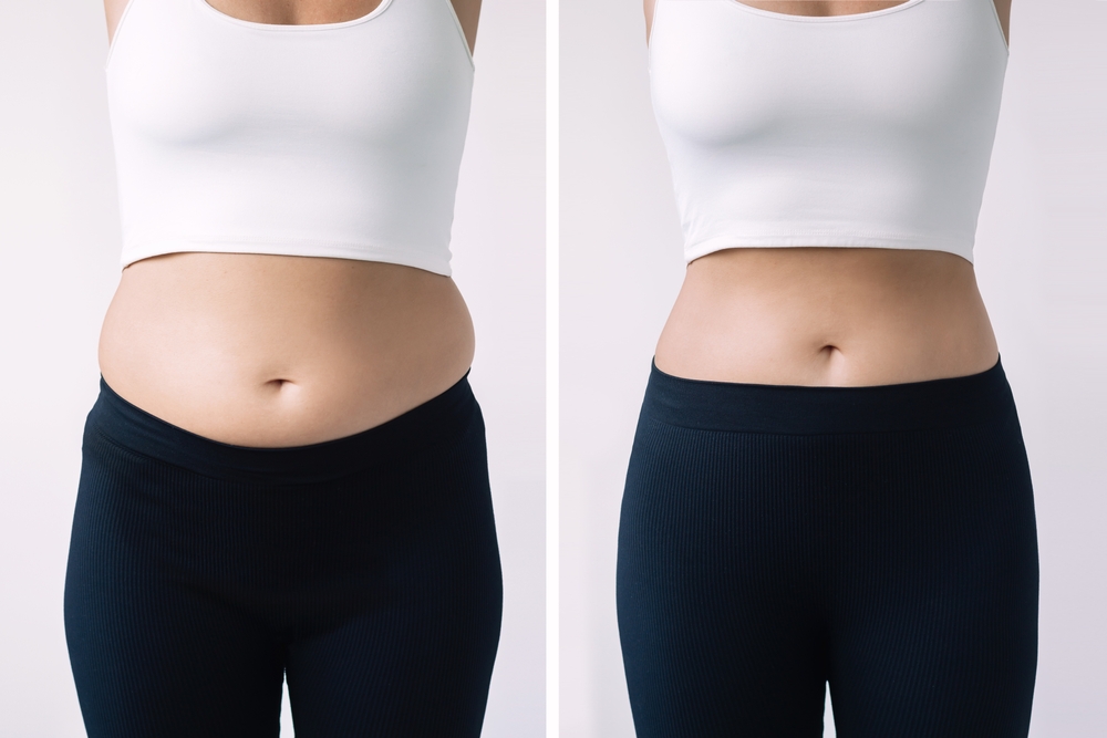 Body Contouring in Dubai for Sculpted Shape and Enhanced Physical Confidence