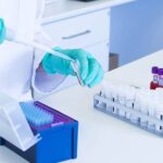 What Controls Are Essential For A Reliable Assay Setup?