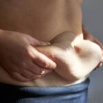 Mini Abdominoplasty Dubai: Quick Fix for Lower Belly Concerns