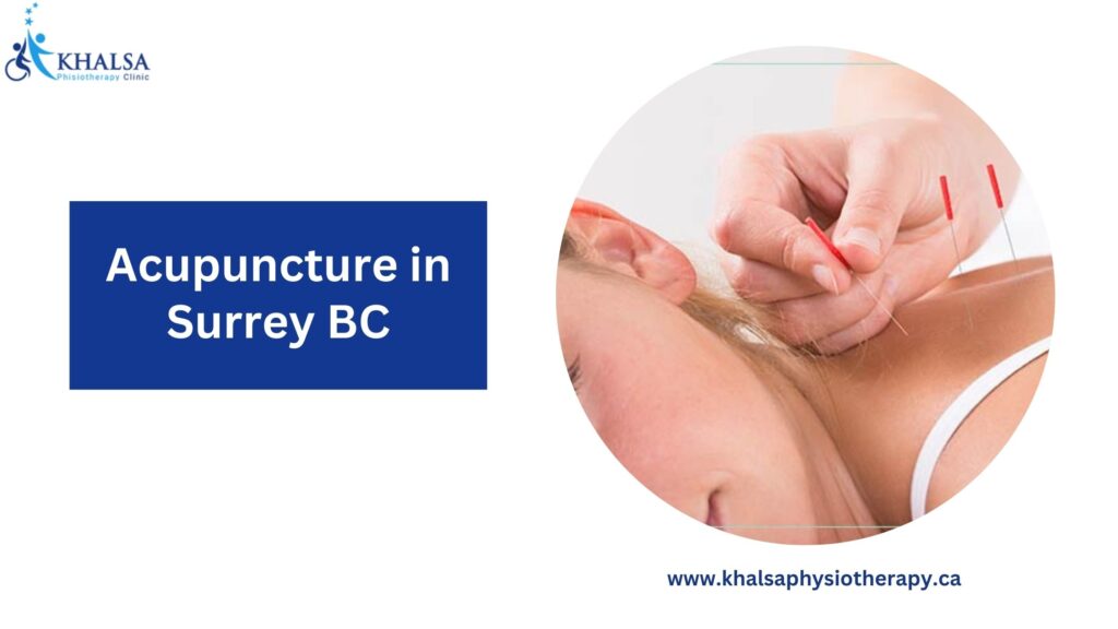 Top 10 Health Benefits of Acupuncture Therapy for Mind and Body