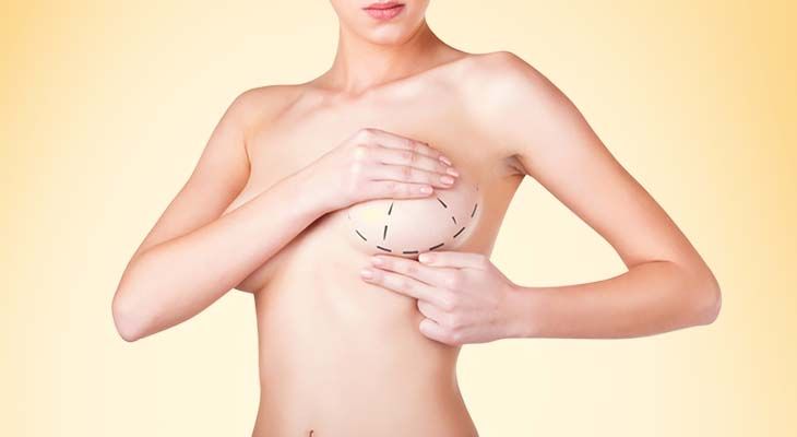 Breast Enlargement Before and After: Real Patient Transformations