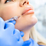 Beginner’s Lip Filler Guide Dubai | First-Time Tips