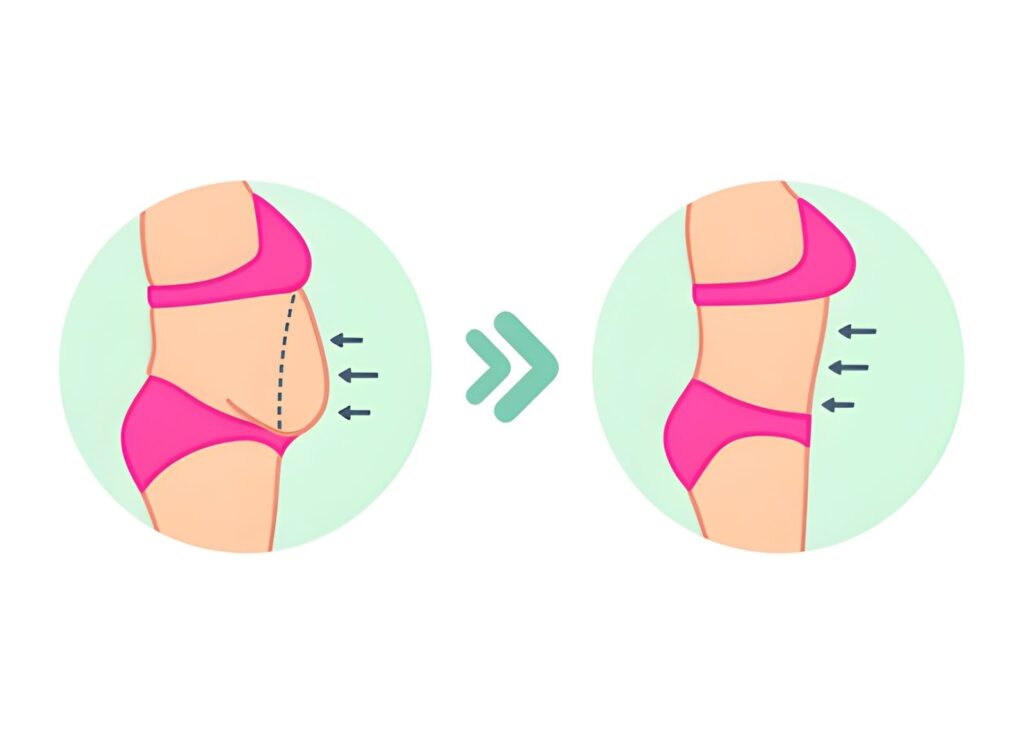 From Consultation to Recovery: A Step-by-Step Guide to the Abdominoplasty Process