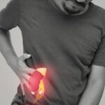 How Long Does It Take to Walk Normally After Knee Replacement?