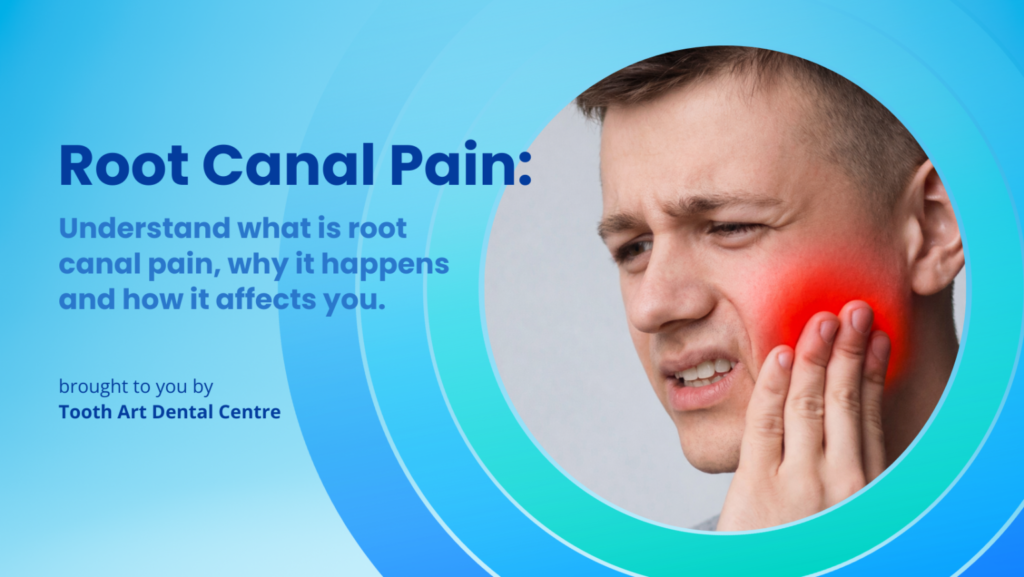 Root Canal Pain: Understand what is root canal pain, why it happens and how it affects you