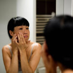 Vitamin A for Freckles and Blemishes Treatment in Dubai | 2026 Guide