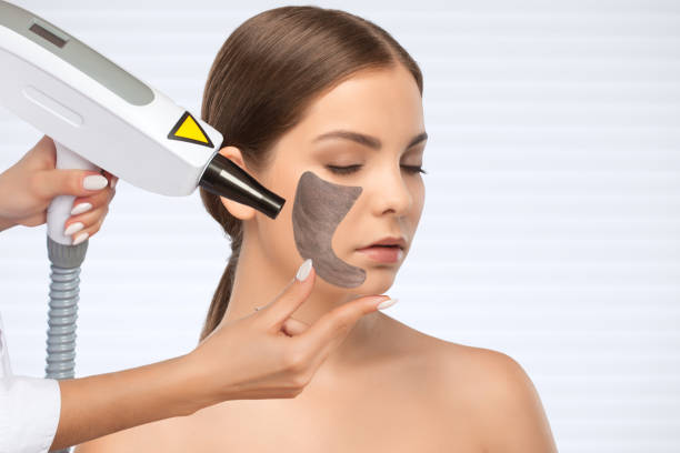Revive Tired Skin Using Spectra Laser Carbon Peeling in Dubai