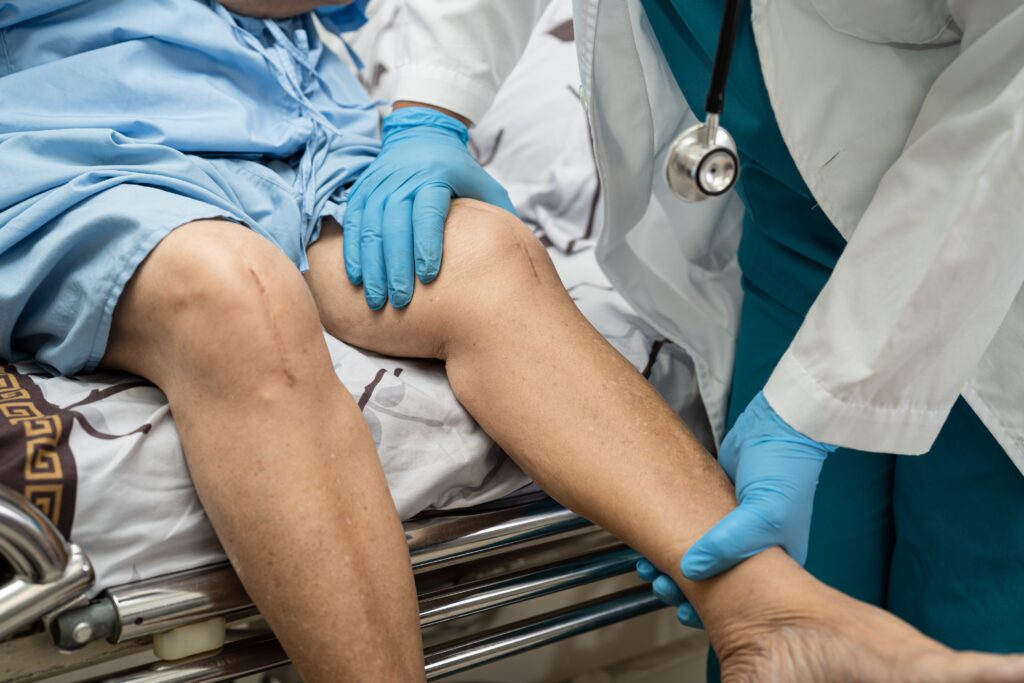 Knee Replacement Planning: The Essential Questions Every Patient Must Ask Before Surgery