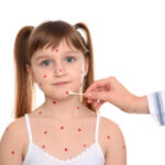 Hemangioma vs Port-Wine Stain Dubai | Diagnosis & Care