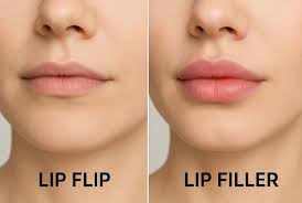 Lip Flip: Wie die Methode die Lippenform beeinflusst
