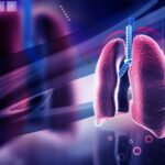 Sarcoidosis Testing and Treatment: What to Expect After Diagnosis