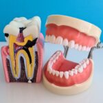 Root Canal Treatment: Common Symptoms Before the Procedure