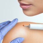 When Should You Seek Professional Treatment for Skin Tag Removal?