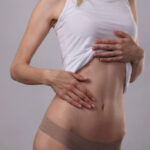 Non-Invasive Body Contouring with Laser Lipolysis Dubai | Tajmeels Clinic