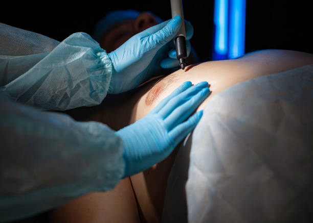 Recovering from Gynaecomastia Surgery in Dubai: 2026 Timeline & Tips