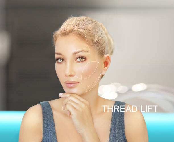 Brow Thread Lift in Dubai: Achieving the ‘Fox Eye’ and Refined Arch