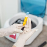 How to Prepare for Your P Shot in Dubai Session